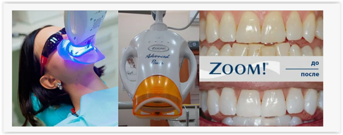  :   Zoom  Philips  !