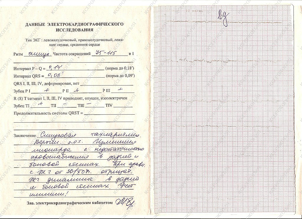 Бланк экг образец для распечатки